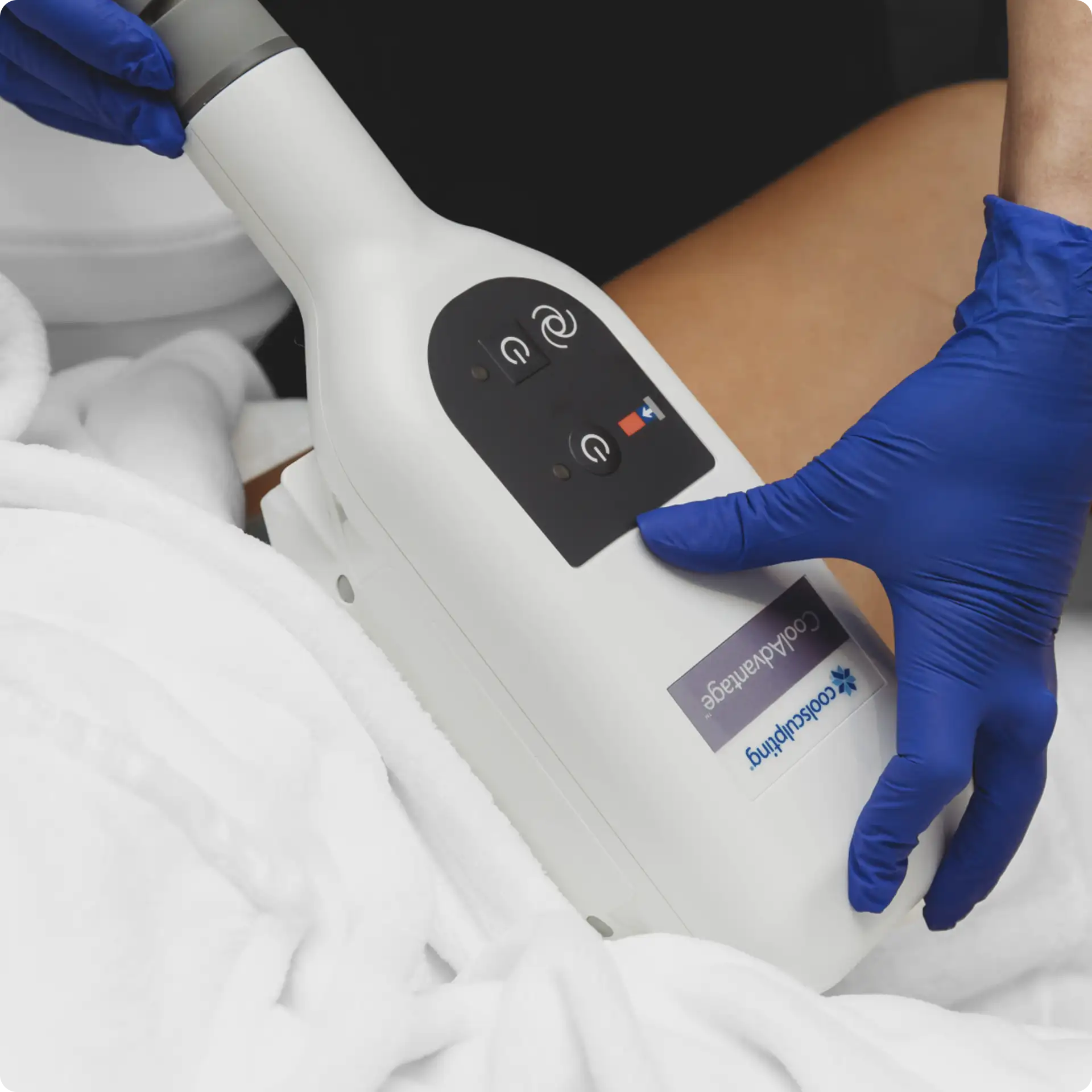 CoolSculpting